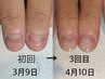 2回目以降 深爪ケア◆弱くて伸びない等のお悩みを解消◎見せたくなる指先に