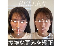 ベレン 堀江(BELLEN)の雰囲気（複雑な歪み矯正が得意！リフトアップもできます！）