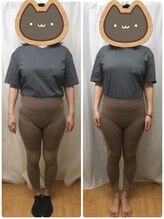 オルテンシア(Hortensia)/ドライ痩身