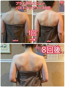 エステティックサロン ベルエトワール住吉店/マッサージビフォーアフター