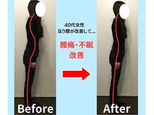 ソヴァール(SAUVEUR)/40代女性　反り腰からの腰痛不眠