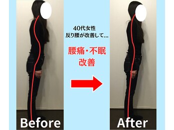 ソヴァール(SAUVEUR)/40代女性　反り腰からの腰痛不眠