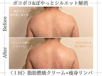 アルム(ALUM)/上半身集中60分＊肩周りに変化を