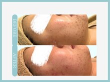 アコガレコガオ 山形店/