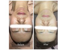 ヒール(heal)の雰囲気（40だいw/毛穴、シミ、しわ、くすみなどお肌改善水美容ケア）