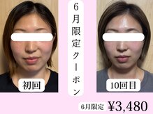 asmot鍼灸 整体院 代々木上原(asmot鍼灸 整体院)