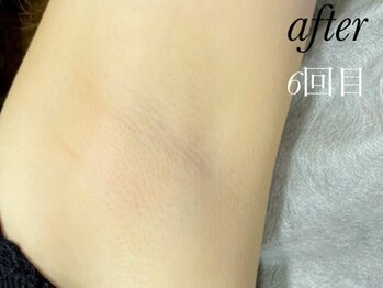 ミニョン(Minyon)/