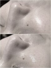 ヒルナム(Heal Nam)/~プロセル~フェイス