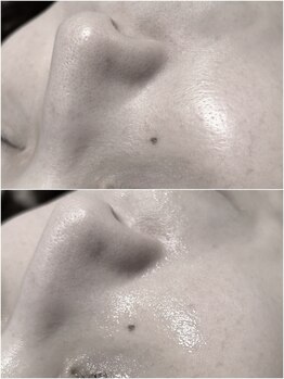 ヒルナム(Heal Nam)/~プロセル~フェイス