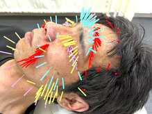 とだ鍼灸院