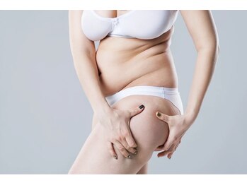 ほんじょう整骨院 美容整体の写真/【成功事例多数！産後の体型変化にお悩みの方に！】土台である骨格の歪みを整え、太もも＆ヒップまでケア◎