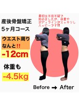 リノア(Linoa)/産後ママさんのビフォーアフター