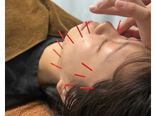 竹の塚トップ鍼灸接骨院/竹の塚接骨院　竹ノ塚駅西口