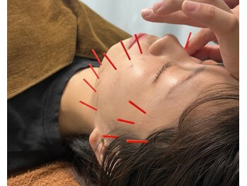 竹の塚トップ鍼灸接骨院/TOP接骨鍼灸竹ノ塚院　竹ノ塚駅