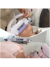 ヴィラシャンゼ スパアンドエステ(VILLA SHANZE)/BBLとビタミン導入がセット