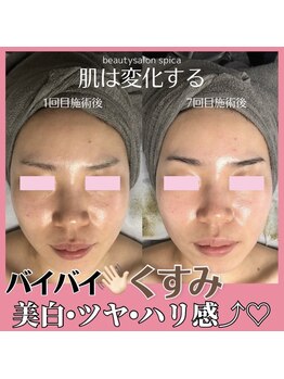 スピカ(Spica)/やればやるほど肌は変わる♪