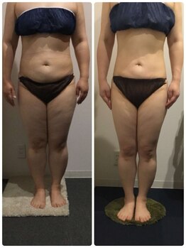 ディタ アンド ボーン(DITA&BORN)/痩身全身