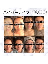 ディライト 名古屋駅店(Delight)/ハイパーナイフ