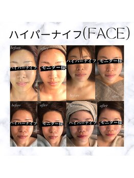 ディライト 名古屋駅店(Delight)/ハイパーナイフ