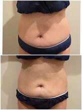 ディアウーマン(Dear Woman)/【ムダ肉集中攻撃＆燃焼】