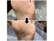 フットレスキュー(Foot ResQ)の雰囲気（20年以上の経験がある爪のスペシャリストにお任せ！）
