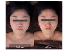 レーヴリゼ(Revelise)/頭蓋骨小顔矯正＋整顔マッサージ