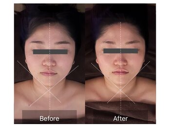 レーヴリゼ(Revelise)/頭蓋骨小顔矯正+整顔マッサージ