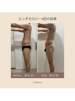 テセラ(Tethere)/エンダモロジー4回の結果!3