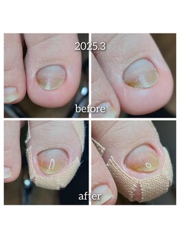 爪切り屋 足楽/