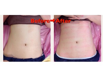 エステティックサロン ココチ(Cocochi)/歪みも反り腰も◎上半身コルギ