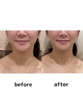 シエル(Ciel)/首ほっそり！肩こり、スッキリ！