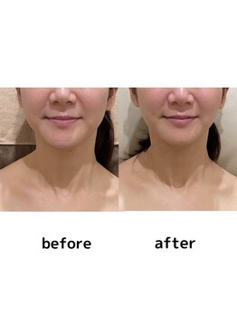 シエル(Ciel)/首ほっそり！肩こり、スッキリ！