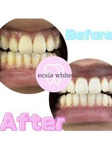 エクシアホワイト 平岸駅前店/