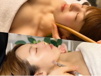 クイーンズチャーム(Queen's Charm)の写真/【結果重視の方にオススメ！】パッチリ目元はツリーで叶える☆今の時期は予約が埋まりやすいのでお早めに！