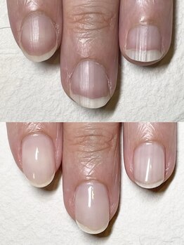 シーム(SeaMu)の写真/爪の形、割れやすいなど土台から整える『自爪育成』と『ケア』で美爪へ