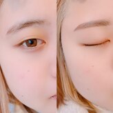 リトラリス(Littoralis)