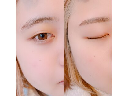 リトラリス(Littoralis)の写真