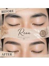 レオン(Reon)