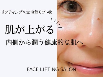 アイジー(iG)の写真/肌が上がる感覚に感動！内側から潤う、憧れの水光肌へ導きます◎ハリと艶もプラス！
