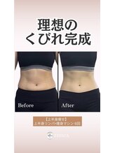 ジヒカ(ZIHICA)/上半身リンパ×痩身マシン