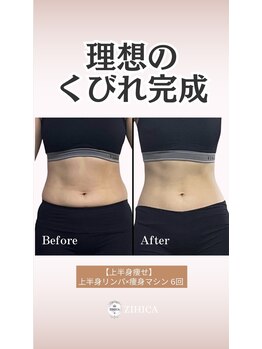 ジヒカ(ZIHICA)/上半身リンパ×痩身マシン