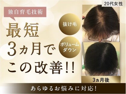 イーズ/リバイタ 梅田本店の写真