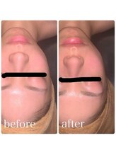 ベルフルール 西18丁目店/韓国コルギ