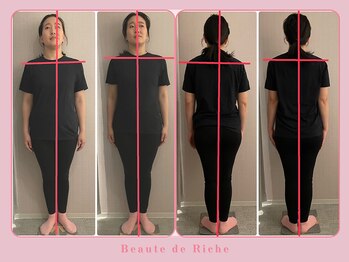 ボーテドリッシュ(Beaute de Riche)/整骨【身体】1回目beforeafter