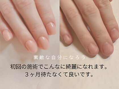 ネイルエデン サロン(NAIL EDEN SALON)の写真
