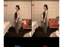 ロアー 赤坂店(RAWR)/姿勢改善で体型改善