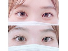 ウィンジュリー(Winjury)/まつげパーマ