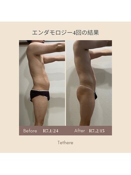 テセラ(Tethere)/エンダモロジー4回の結果!4