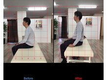 ストレチックス 近江八幡店/BeforeAfter