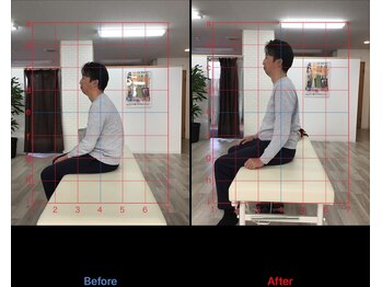 ストレチックス 近江八幡店/BeforeAfter